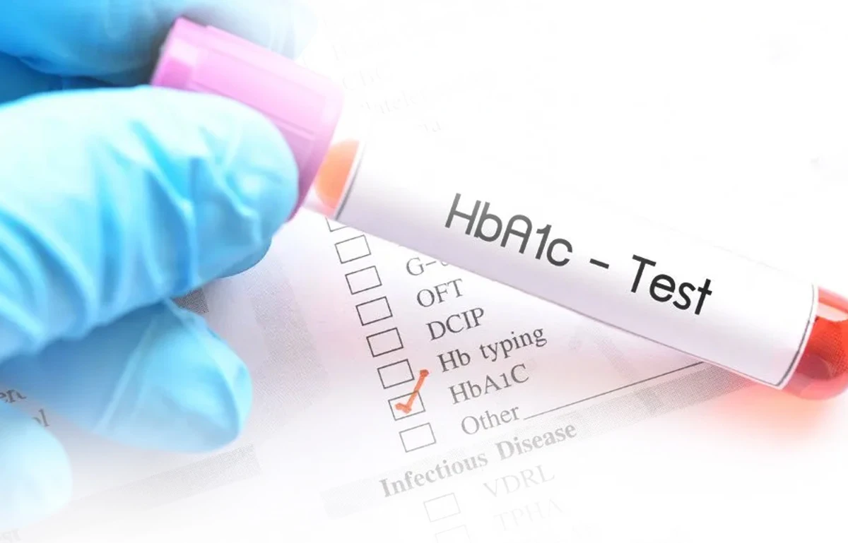 A1c normal test