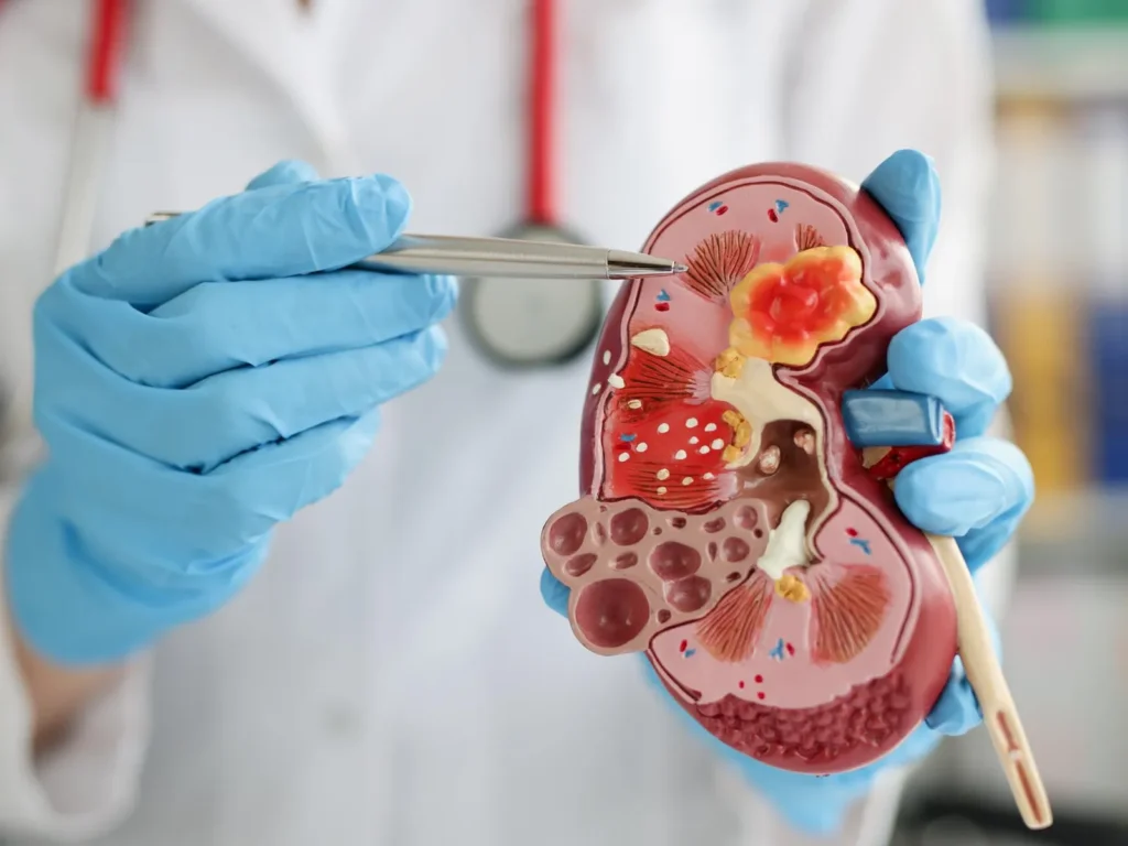 nephorologist at ccd medical center faisalabad
